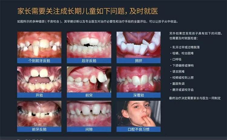 兒童牙齒早期干預矯治真的有必要嗎？